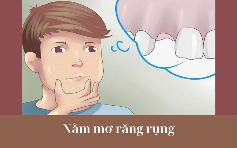 Mơ răng rụng là điềm tốt hay xấu